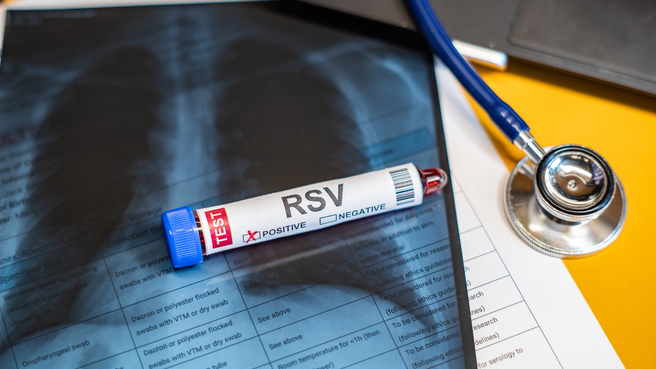 RSV Designations Reached All-Time High in 2022, Data Shows