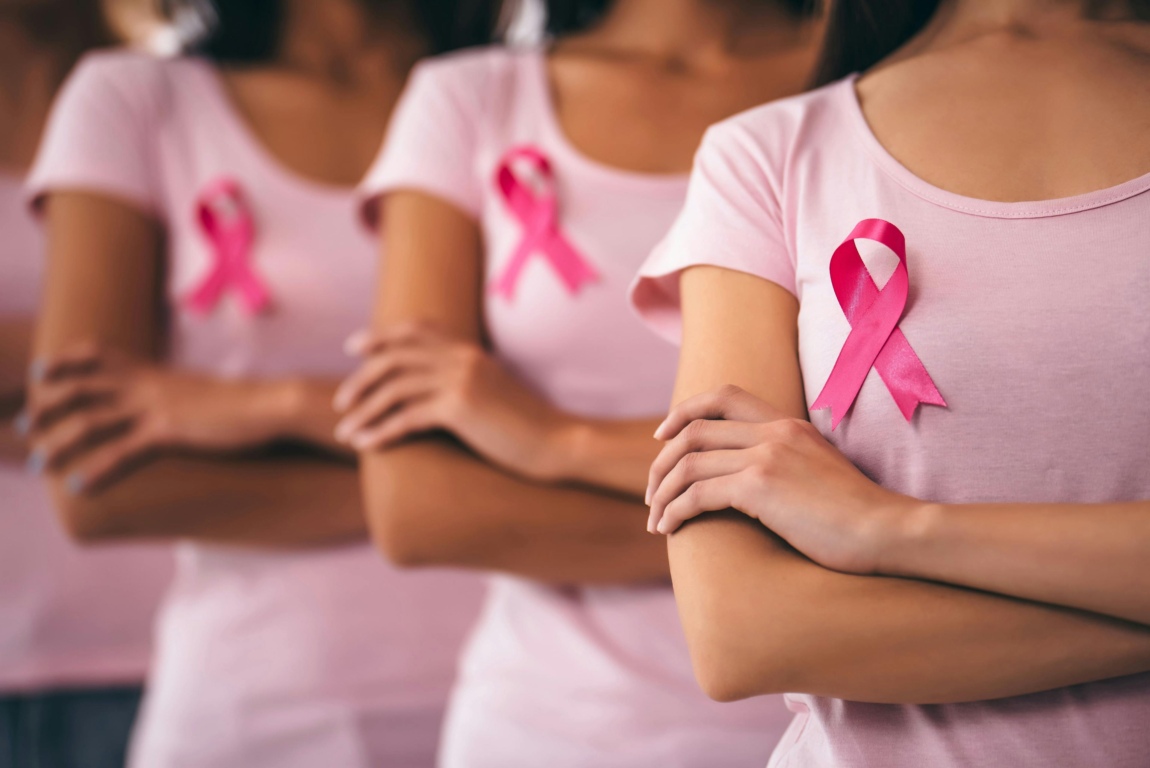 The Benefits and Privacy Concerns in Utilizing Artificial Intelligence for Early Detection of Breast Cancer